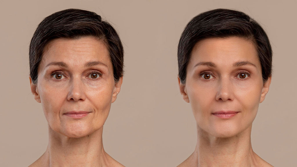 What is Your Skin?
